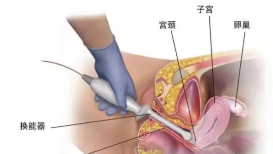 县城贵妇最爱的“秋裤”股价崩盘,澳门管家婆三肖三码100%中,最新核心解答落实_经典版V11.93
